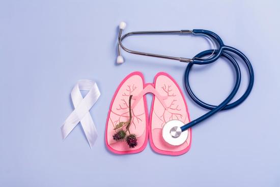 Cancer du poumon stade 4 : quelle est l’espérance de vie ?