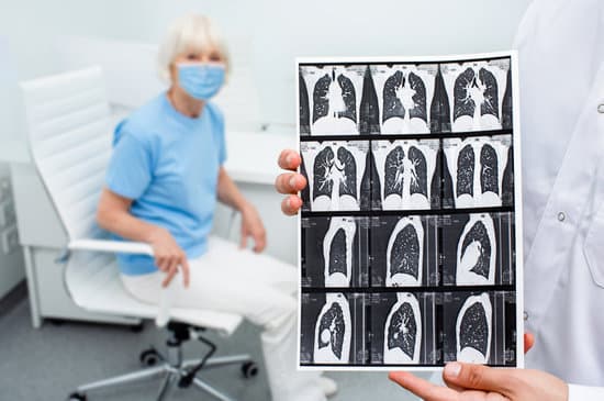 Comprendre les Taches au Poumon : Causes, Diagnostic et Traitement