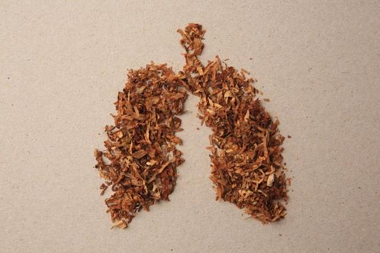 Introduction au Cancer du Poumon Lié au Tabac