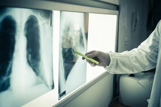 Radiographie Poumons d'un fumeur vs poumons sains