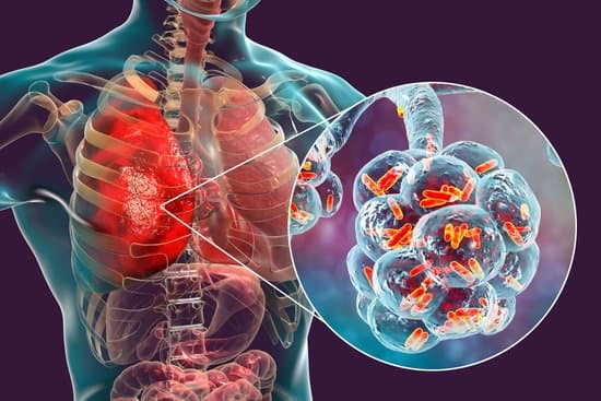 Symptômes du carcinome épidermoïde pulmonaire